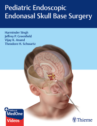 Omslagafbeelding: Pediatric Endoscopic Endonasal Skull Base Surgery 1st edition 9781626235014