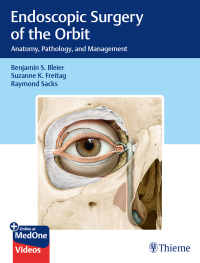 Cover image: Endoscopic Surgery of the Orbit 1st edition 9781626235052