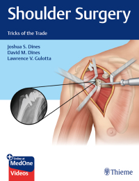 Immagine di copertina: Shoulder Surgery 1st edition 9781626235168