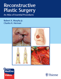 Cover image: Reconstructive Plastic Surgery 1st edition 9781626235175