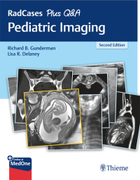 Omslagafbeelding: RadCases Plus Q&A Pediatric Imaging 2nd edition 9781626235199
