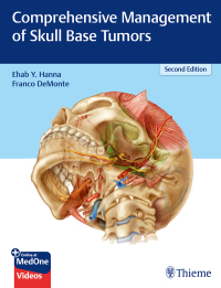 Cover image: Comprehensive Management of Skull Base Tumors 2nd edition 9781626235328