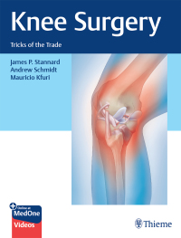 Titelbild: Knee Surgery 1st edition 9781626235410