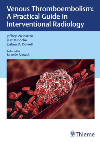 Imagen de portada: Venous Thromboembolism 1st edition 9781626236042