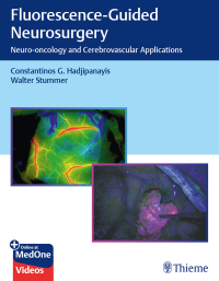 表紙画像: Fluorescence-Guided Neurosurgery 1st edition 9781626237148