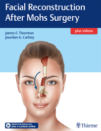 Cover image: Facial Reconstruction After Mohs Surgery 1st edition 9781626237346