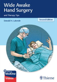 Cover image: Wide Awake Hand Surgery and Therapy Tips 2nd edition 9781684202300