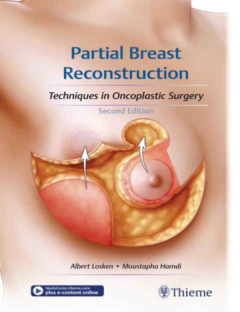 Partial Breast Reconstruction: Techniques in Oncoplastic Surgery, 2nd Edition - FULL INSTANT DOWNLOAD | PDF DOCX EPUB