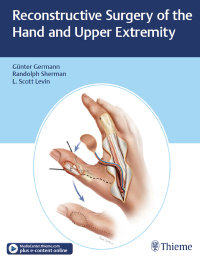 Cover image: Reconstructive Surgery of the Hand and Upper Extremity 1st edition 9781626236011