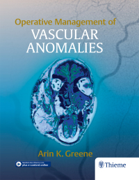 Cover image: Operative Management of Vascular Anomalies 1st edition 9781626236905