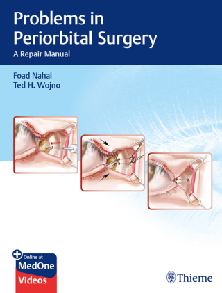 Cover image: Problems in Periorbital Surgery 1st edition 9781626237087