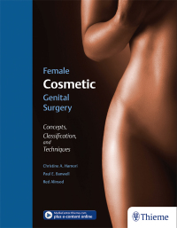 Cover image: Female Cosmetic Genital Surgery 1st edition 9781626236493