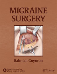 Cover image: Migraine Surgery 1st edition 9781626236929