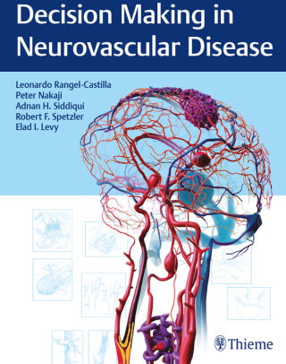 Cover image: Decision Making in Neurovascular Disease 1st edition 9781684200573
