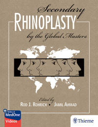 Imagen de portada: Secondary Rhinoplasty by the Global Masters 1st edition 9781626236783