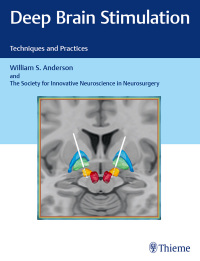 Immagine di copertina: Deep Brain Stimulation 1st edition 9781626237971