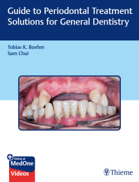 Imagen de portada: Guide to Periodontal Treatment Solutions for General Dentistry 1st edition 9781626238008