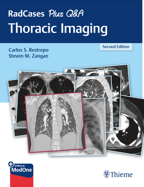 RadCases Plus Q&A Thoracic Imaging, 2nd Edition - FULL INSTANT DOWNLOAD | PDF DOCX EPUB