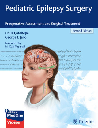 Cover image: Pediatric Epilepsy Surgery 2nd edition 9781626238169
