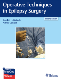 Cover image: Operative Techniques in Epilepsy Surgery 2nd edition 9781626238183
