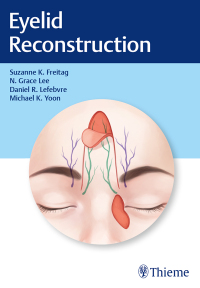Cover image: Eyelid Reconstruction 1st edition 9781626238237