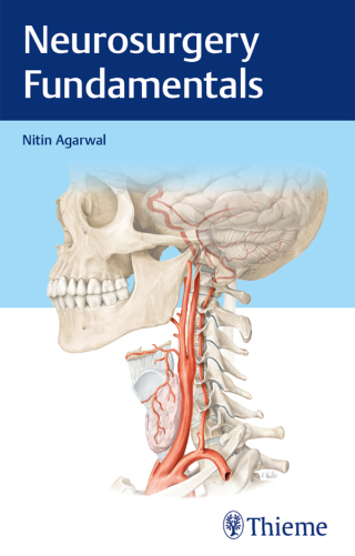 Cover image: Neurosurgery Fundamentals 1st edition 9781626238220
