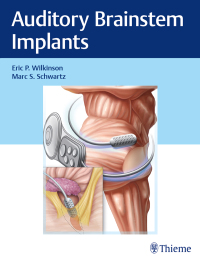 Imagen de portada: Auditory Brainstem Implants 1st edition 9781626238268