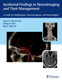 Cover image: Incidental Findings in Neuroimaging and Their Management 1st edition 9781626238282