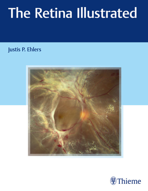 The Retina Illustrated, 1st Edition - FULL INSTANT DOWNLOAD | PDF DOCX EPUB
