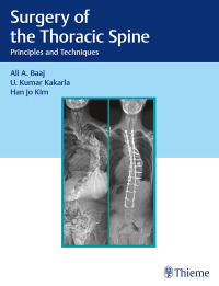 Immagine di copertina: Surgery of the Thoracic Spine 1st edition 9781626238558