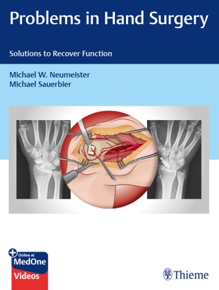 Cover image: Problems in Hand Surgery 1st edition 9781626237094