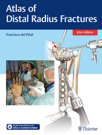 صورة الغلاف: Atlas of Distal Radius Fractures 1st edition 9781626236790