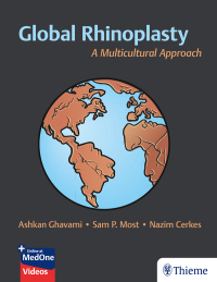 Cover image: Global Rhinoplasty 1st edition 9781626238916