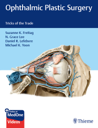 Immagine di copertina: Ophthalmic Plastic Surgery 1st edition 9781626238978
