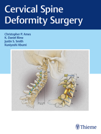 Imagen de portada: Cervical Spine Deformity Surgery 1st edition 9781626239012