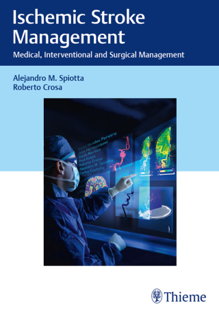 Immagine di copertina: Ischemic Stroke Management 1st edition 9781626239081