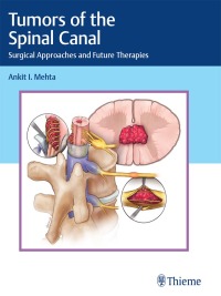صورة الغلاف: Tumors of the Spinal Canal 1st edition 9781626239319