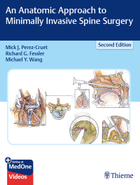 Cover image: An Anatomic Approach to Minimally Invasive Spine Surgery 2nd edition 9781626236431