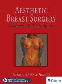 Cover image: Aesthetic Breast Surgery 1st edition 9781626236141