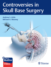 Imagen de portada: Controversies in Skull Base Surgery 1st edition 9781626239531