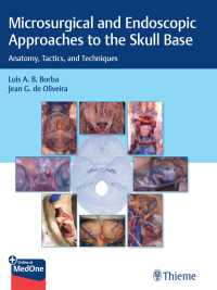 Imagen de portada: Microsurgical and Endoscopic Approaches to the Skull Base 1st edition 9781626239661