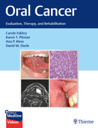 Cover image: Oral Cancer 1st edition 9781626239685