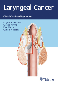 Imagen de portada: Laryngeal Cancer 1st edition 9781684200016
