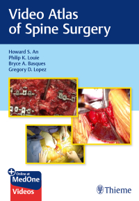 Cover image: Video Atlas of Spine Surgery 1st edition 9781684200054