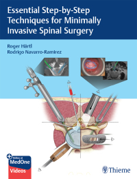 Imagen de portada: Essential Step-by-Step Techniques for Minimally Invasive Spinal Surgery 1st edition 9781684200092