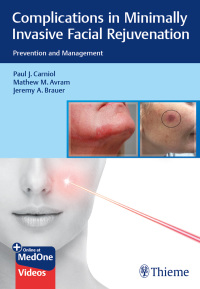 Cover image: Complications in Minimally Invasive Facial Rejuvenation 1st edition 9781684200139