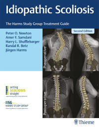 Cover image: Idiopathic Scoliosis 2nd edition 9781684200559