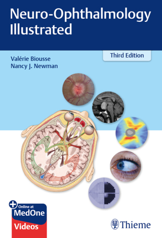 Cover image: Neuro-Ophthalmology Illustrated 3rd edition 9781684200740
