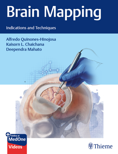 Brain Mapping: Indications and Techniques, 1st Edition - FULL INSTANT DOWNLOAD | PDF DOCX EPUB