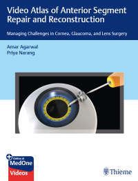 Cover image: Video Atlas of Anterior Segment Repair and Reconstruction 1st edition 9781684200979